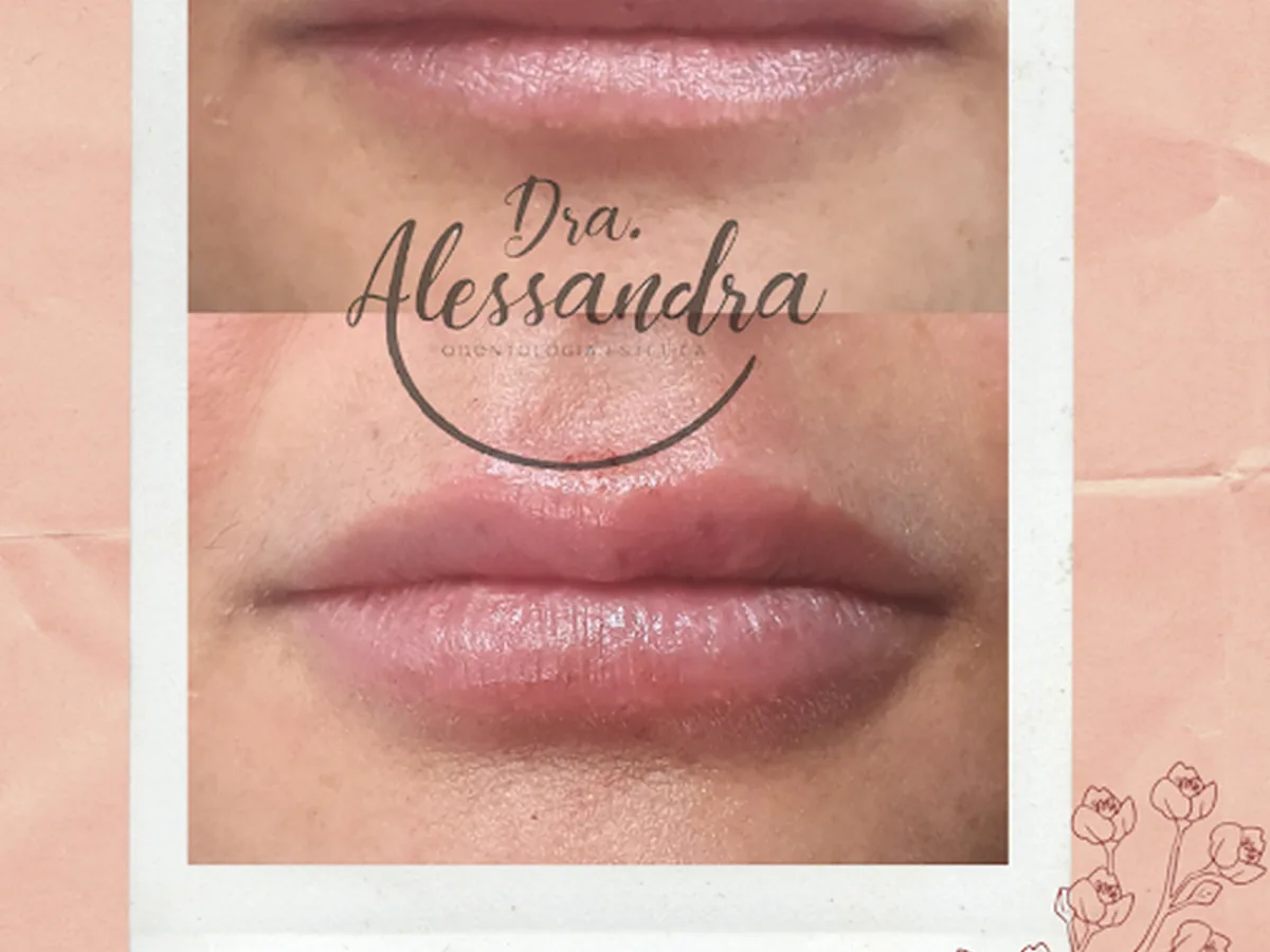 Dra. Alessandra Barros — dentista em Centro Empresarial Taquari, São José dos Campos