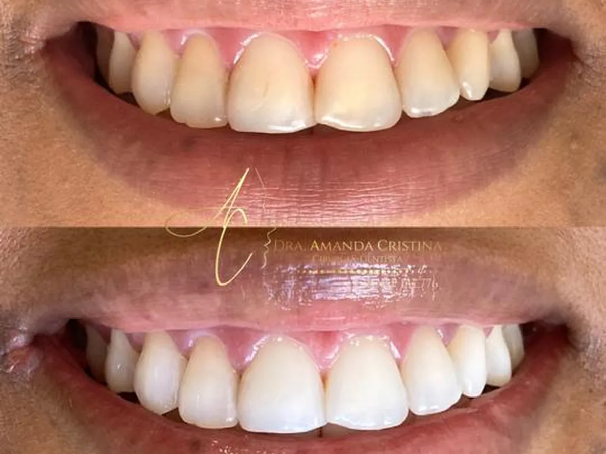 Dra Amanda Cristina — dentista em Centro, São José dos Campos
