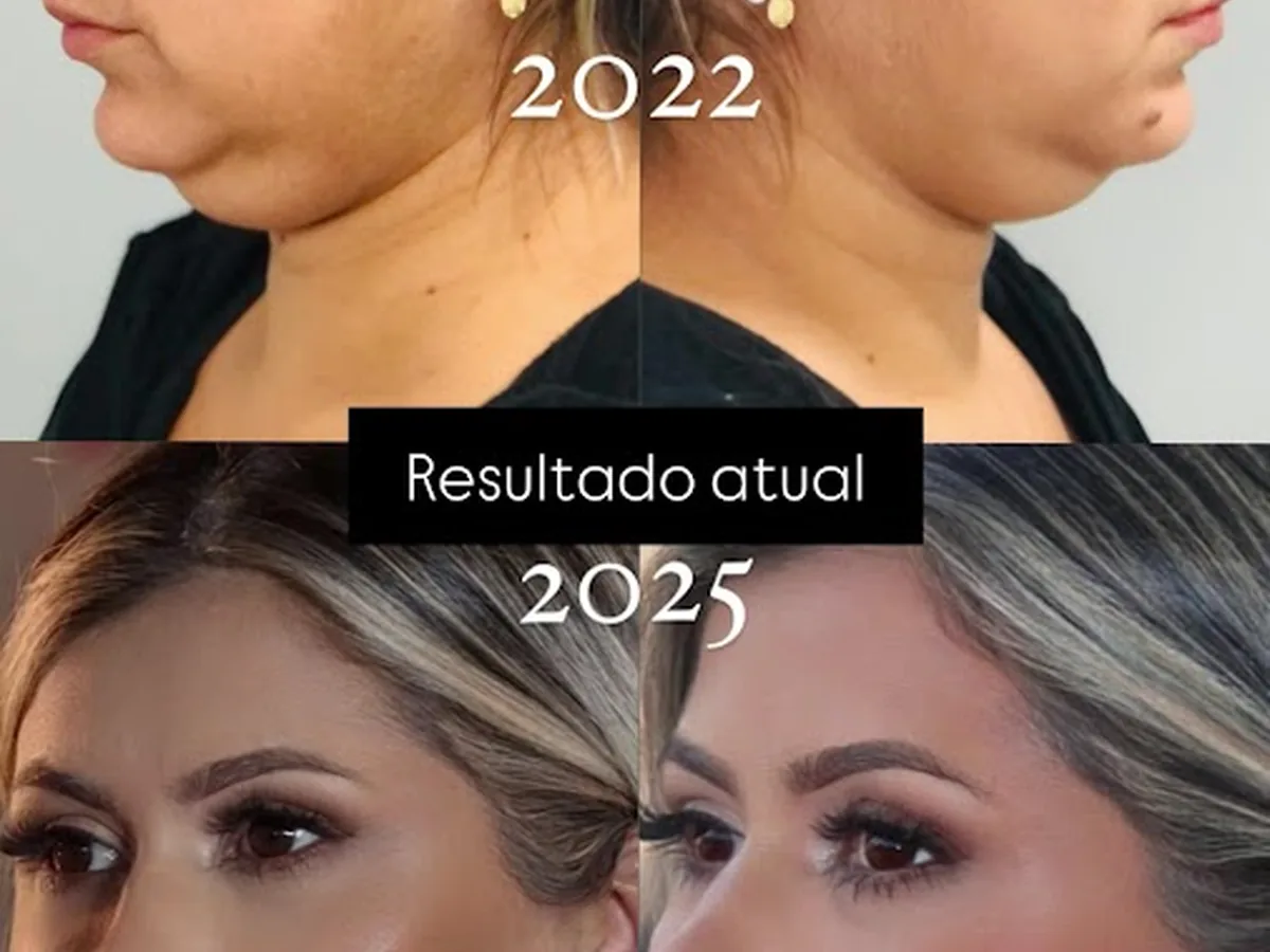 Dra Catarine Ferreira Oliveira — dentista em Vila Industrial, São José dos Campos