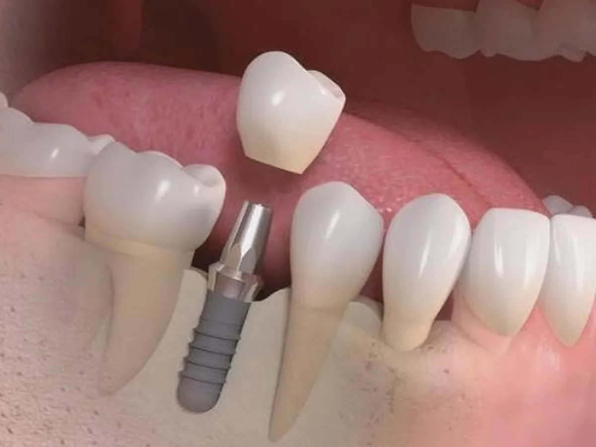 Dra. Mariana — dentista em Jardim Aquarius, São José dos Campos