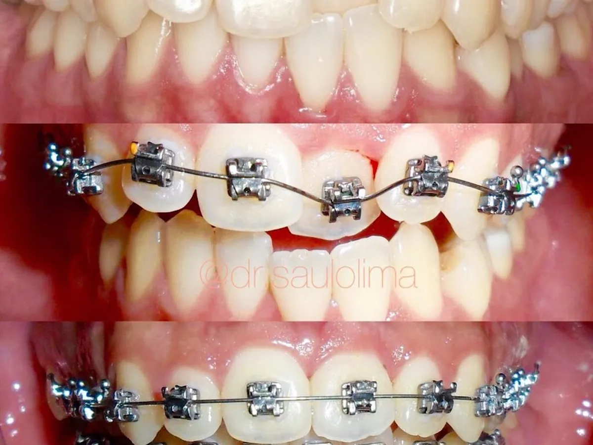Dr. Saulo Lima — dentista em Jardim das Colinas, São José dos Campos