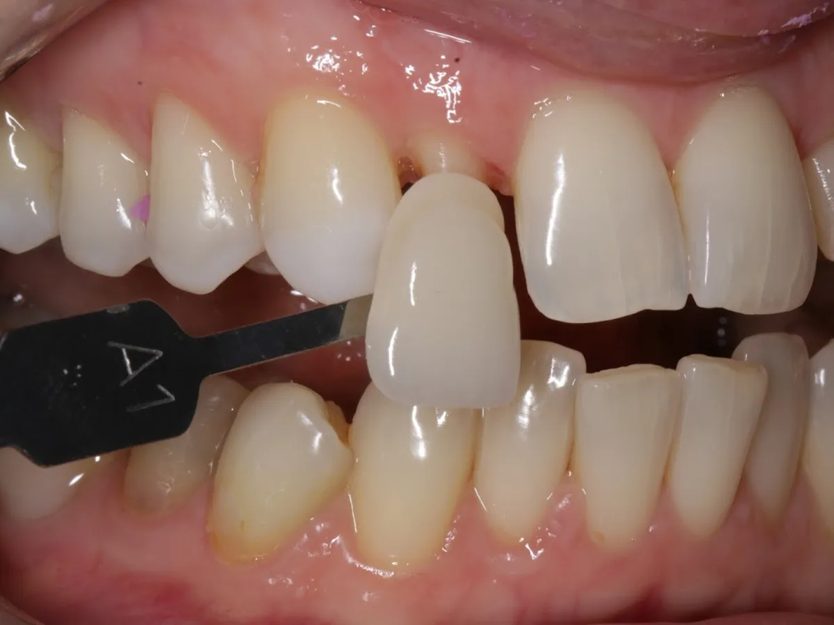 Odontologia Familiar Ana Paula Bessa — dentista em Vila Adyana, São José dos Campos