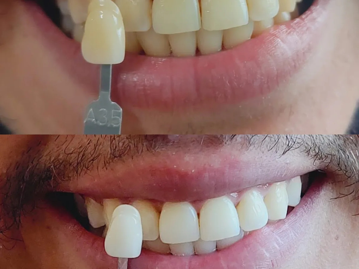 Ortho Express Clínica Odontológica — dentista em Jardim das Cerejeiras, São José dos Campos