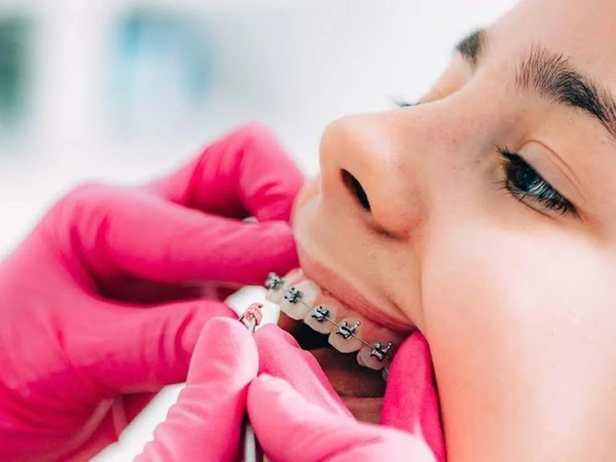 Sorriso Prime — dentista em Centro, São José dos Campos